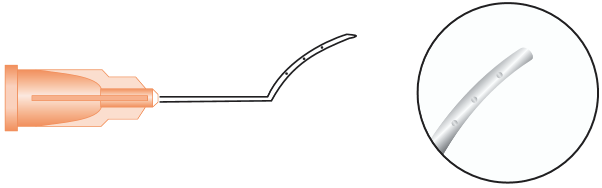 Lasik Irrigating Cannula